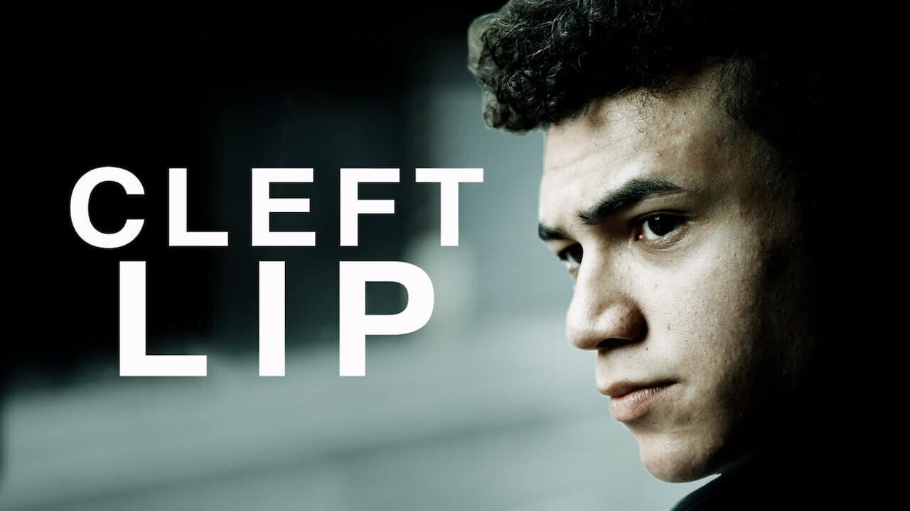 Szene aus Cleft Lip